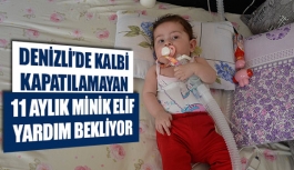 Denizli’de kalbi kapatılamayan 11 aylık minik Elif yardım bekliyor 