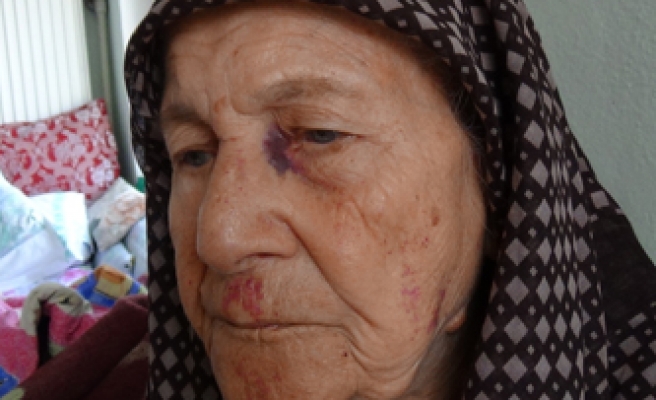 Vicdansızlar 86 yaşındaki kadını döverek 5 bileziğini gasp ettiler